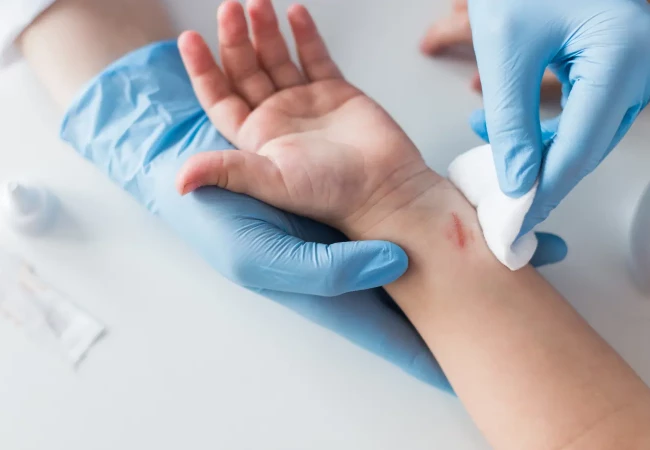 Click here to learn more about wound cleaning